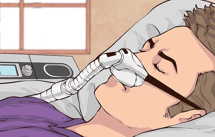 睡眠呼吸機全攻略：種類、原理及選擇指南